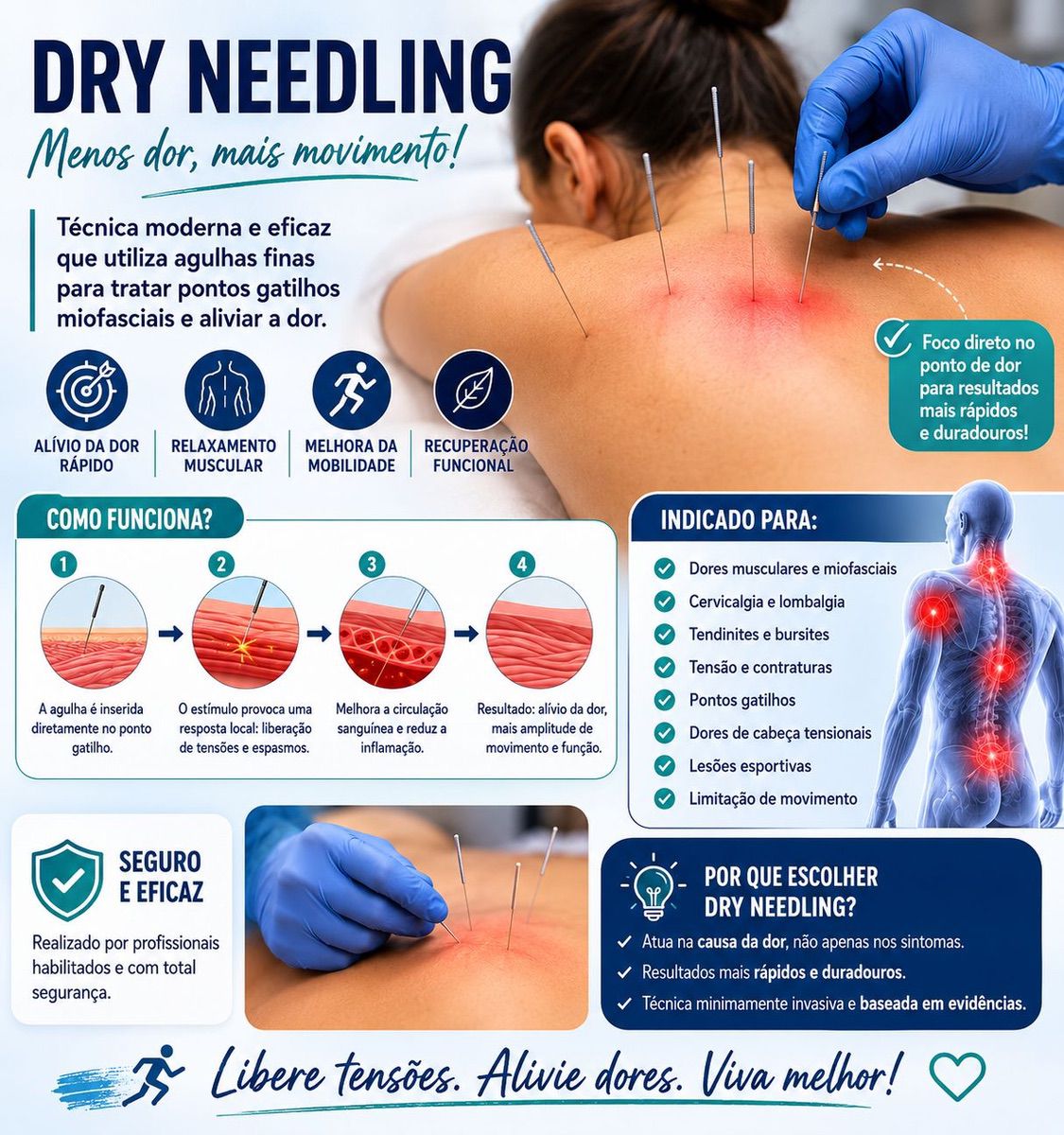 Diagrama do funcionamento de dry needling